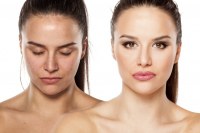 Aquapeel INNOFACIAL prej/potem